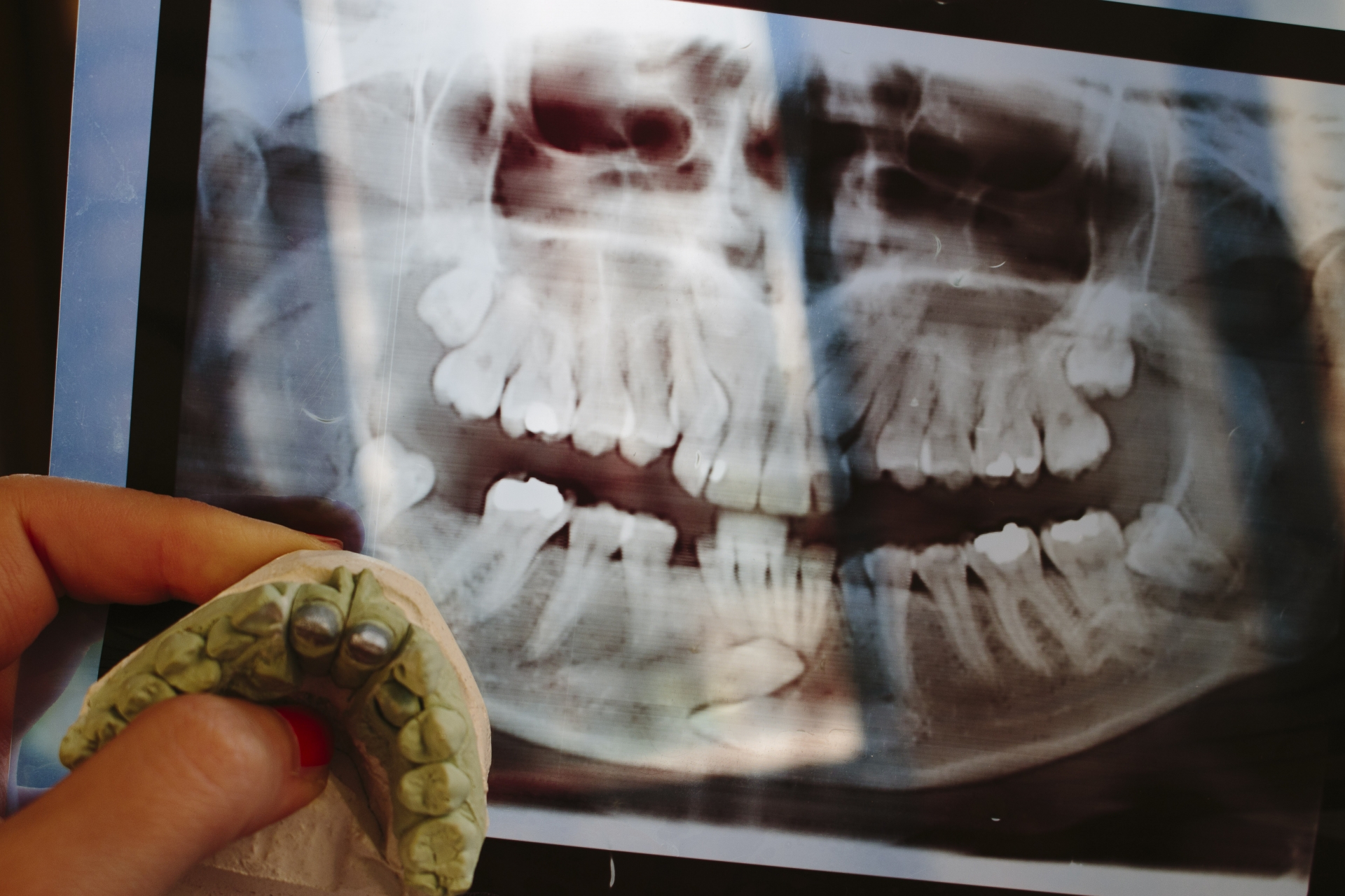 歯科医院のデジタル化とは？デジタルデンティストリーの技術やメリットまとめ