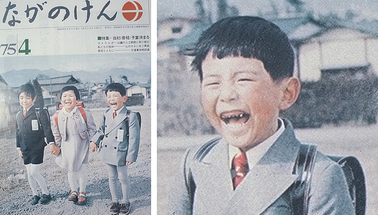 日本の小児の齲蝕減少の歴史 その1