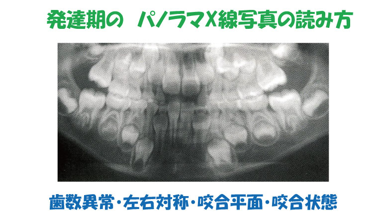 発達期における咬合の変化　その7　乳歯列のパノラマX線写真の読み方