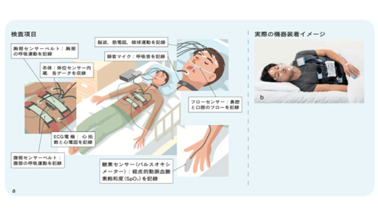 閉塞性睡眠時無呼吸（OSA）治療のための睡眠歯科講座 第6回：睡眠時無呼吸検査とは？